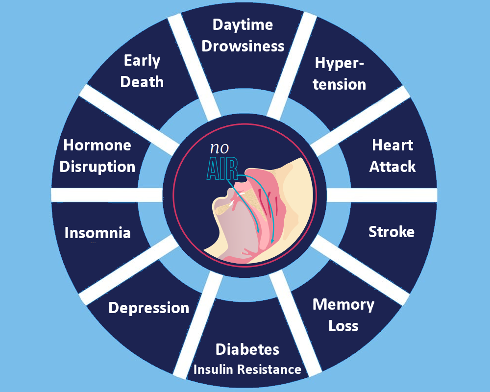 Obstructive Sleep Disorder symptoms